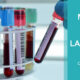 marketing para laboratorios clinicos